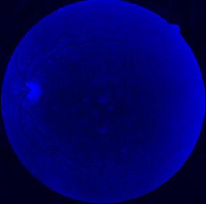 Image imagens/AndJ-l-blue.jpg