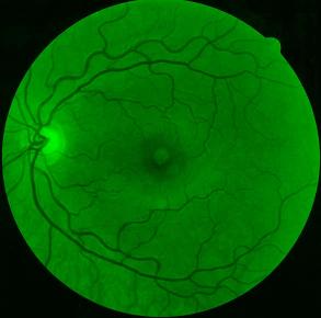 Image imagens/AndJ-l-green.jpg