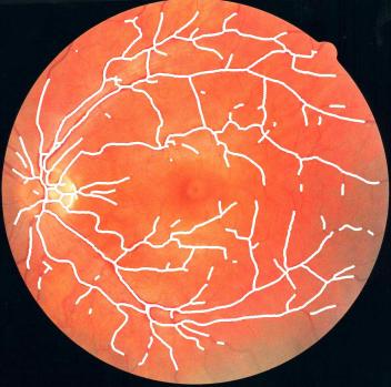 Image imagens/SadJ-l-class-trained-by-gmm-AndJ-l-final.jpg